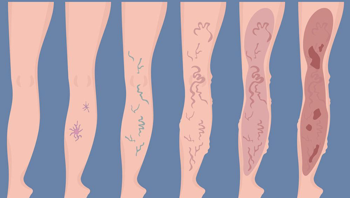 Cuidado personal en casa